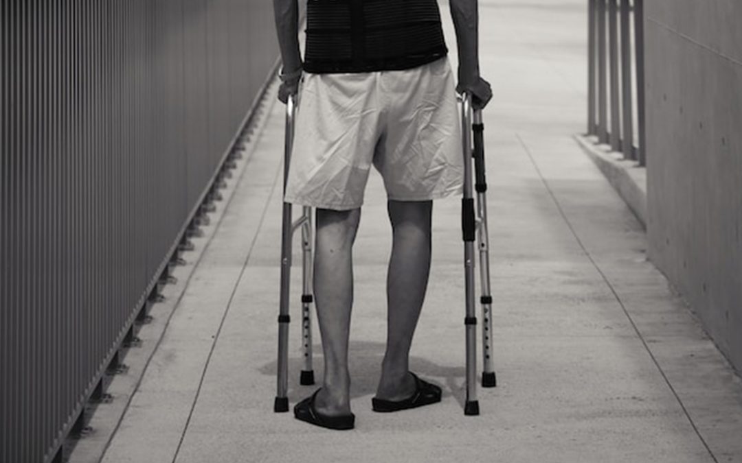 Physiotherapy for knee osteoarthritis